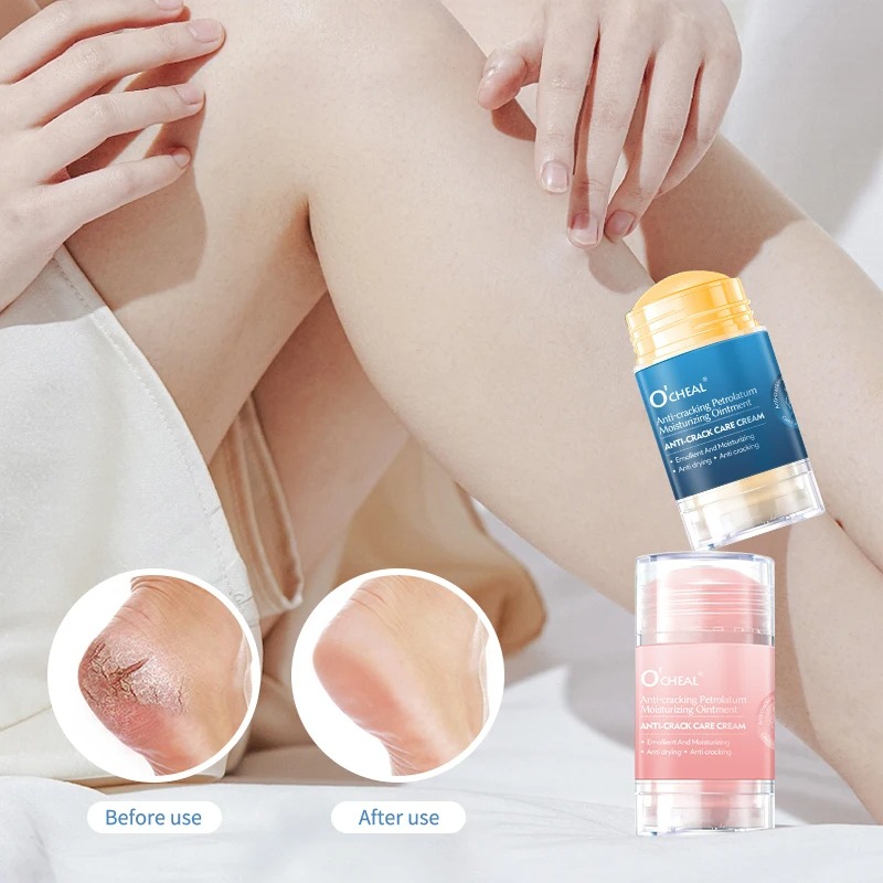 Anti-kloof voetcrème voor drog - Heels recensie en prijs
